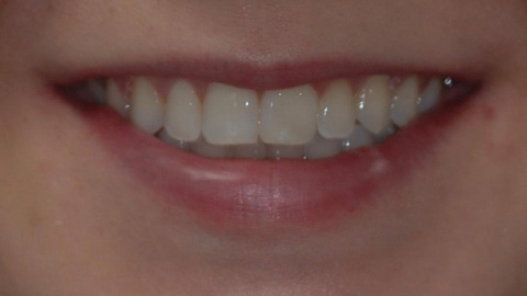 After