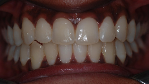 After