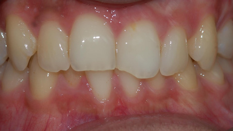 Before